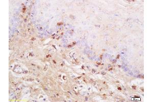 Formalin-fixed and paraffin embedded rat tongue labeled with Anti SynCAM/TSLC1 Polyclonal Antibody, Unconjugated (ABIN761351) at 1:200 followed by conjugation to the secondary antibody and DAB staining (CADM1 抗体  (AA 65-160))