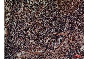 Immunohistochemistry (IHC) analysis of paraffin-embedded Human Lymph, antibody was diluted at 1:100. (CD1d 抗体  (Internal Region))