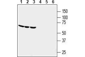 Western blot analysis of human THP-1 monocytic leukemia (lanes 1 and 4), human HL-60 promyelocytic leukemia (lanes 2 and 5) and human U-87 MG glioblastoma (lanes 3 and 6) cell line lysates: - 1-3. (GPR84 抗体  (2nd Extracellular Loop))