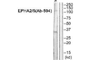 Western blot analysis of extracts from JK cells, using EPHA2/5 (Ab-594) Antibody. (EPHA2/5 (Tyr594) 抗体)