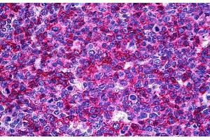 Human Tonsil: Formalin-Fixed, Paraffin-Embedded (FFPE) (USP33 抗体  (AA 327-427))