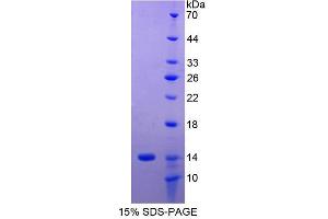 SDS-PAGE analysis of Human MHCG Protein. (HLAG 蛋白)
