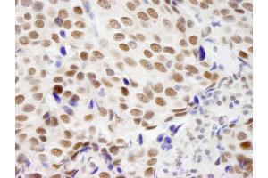 Immunohistochemistry (IHC) image for anti-Zinc Finger Protein 261 (ZMYM3) (AA 250-300) antibody (ABIN7448881) (ZMYM3 抗体  (AA 250-300))