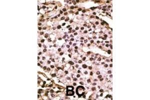 Immunohistochemistry (Paraffin-embedded Sections) (IHC (p)) image for anti-ATG9 Autophagy Related 9 Homolog A (S. Cerevisiae) (ATG9A) (AA 717-746), (C-Term) antibody (ABIN388528)