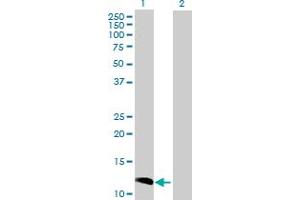 Western Blot analysis of CCL23 expression in transfected 293T cell line by CCL23 MaxPab polyclonal antibody. (CCL23 抗体  (AA 1-137))