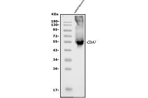 Western blot analysis of CD47 using anti-CD47 antibody (ABIN6719291).