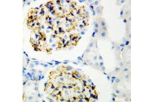 IHC-P: CD34 antibody testing of rat kidney (CD34 抗体  (C-Term))