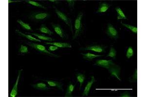 Immunofluorescence of purified MaxPab antibody to ZCRB1 on HeLa cell. (ZCRB1 抗体  (AA 1-217))