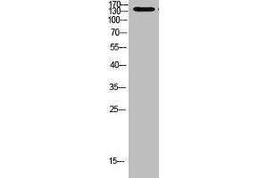 Western Blot analysis of 293t cells using Antibody diluted at 1000 (MIB1 抗体  (AA 901-950))