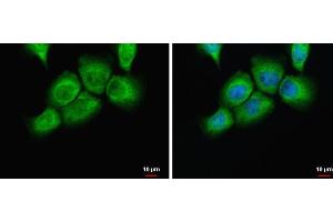 ICC/IF Image uPAR antibody detects uPAR protein at cytoplasm by immunofluorescent analysis. (PLAUR 抗体)