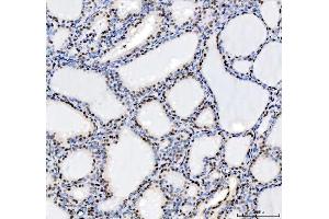 IHC analysis of HDAC2 using anti-HDAC2 antibody (ABIN7601564). (HDAC2 抗体  (AA 387-488))