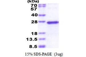 SDS-PAGE (SDS) image for TGFB-Induced Factor Homeobox 2-Like, Y-Linked (TGIF2LY) (AA 1-185) protein (His tag) (ABIN5853539)