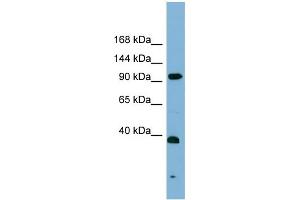 Western Blotting (WB) image for anti-Excision Repair Cross-Complementing Rodent Repair Deficiency, Complementation Group 4 (ERCC4) (Middle Region) antibody (ABIN2787618)