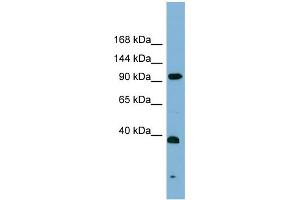 WB Suggested Anti-ERCC4  Antibody Titration: 0. (ERCC4 抗体  (Middle Region))