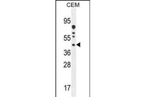 DNAJC22 Antibody (C-term) (ABIN654825 and ABIN2844500) western blot analysis in CEM cell line lysates (35 μg/lane). (DNAJC22 抗体  (C-Term))