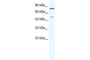 Western Blot showing ZNF12 antibody used at a concentration of 1-2 ug/ml to detect its target protein. (ZNF12 抗体  (N-Term))