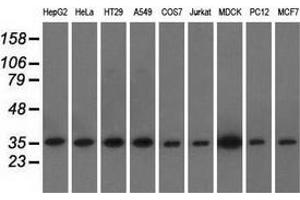 Western blot analysis of extracts (35 µg) from 9 different cell lines by using anti-EIF2S1 monoclonal antibody. (EIF2S1 抗体)