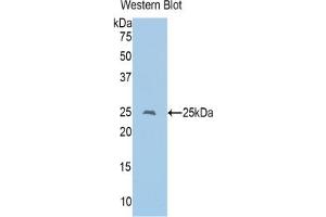 Western blot analysis of the recombinant protein. (CD8 alpha 抗体  (AA 26-236))