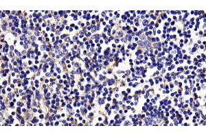 Immunohistochemistry (IHC) image for anti-Collagen, Type I, alpha 1 (COL1A1) (AA 1218-1440) antibody (ABIN7425806)