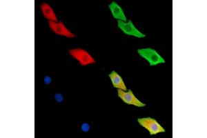 ABIN6259639 and ABIN6279465 staining Hela cells by IF/ICC.