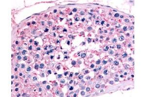 Immunohistochemistry (IHC) image for anti-Nuclear Receptor Subfamily 6, Group A, Member 1 (NR6A1) (Ligand Binding Domain) antibody (ABIN1049148)