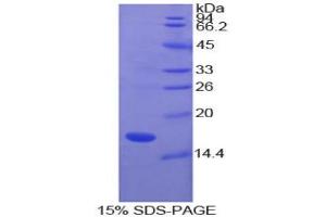 SDS-PAGE analysis of Cow SOD1 Protein.