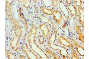 Immunohistochemistry of paraffin-embedded human kidney tissue using ABIN7154092 at dilution of 1:100 (GSTa2 抗体  (AA 1-222))