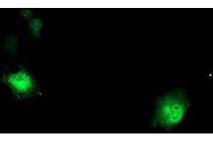Anti-DTNB mouse monoclonal antibody (ABIN2455583) immunofluorescent staining of COS7 cells transiently transfected by pCMV6-ENTRY DTNB (RC203798). (Dystrobrevin beta 抗体)