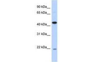 Image no. 1 for anti-RNA-Binding Protein NOB1 (NOB1) (AA 35-84) antibody (ABIN6741274) (NOB1 抗体  (AA 35-84))