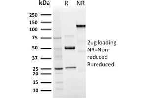 SDS-PAGE Analysis Purified Langerin Recombinant Rabbit Monoclonal Antibody (LGRN/3136R). (Recombinant CD207 抗体  (AA 74-213))