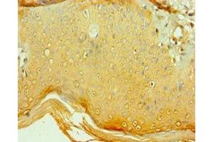 Immunohistochemistry of paraffin-embedded human skin tissue using ABIN7148493 at dilution of 1:100 (COPS2 抗体  (AA 1-310))