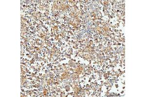 IHC analysis of CP110 using anti-CP110 antibody (ABIN5693312).