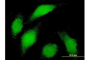 Immunofluorescence of monoclonal antibody to BUB1 on HeLa cell.