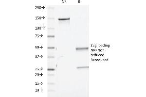 SDS-PAGE Analysis Purified TGF beta Mouse Monoclonal Antibody (TGFB/510). (TGF-beta 抗体)