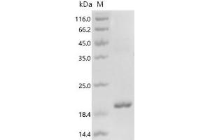 (Tris-Glycine gel) Discontinuous SDS-PAGE (reduced) with 5 % enrichment gel and 15 % separation gel.