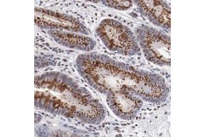Immunohistochemical staining of human stomach with BEGAIN polyclonal antibody  shows strong cytoplasmic positivity in granular pattern in glandular cells at 1:200-1:500 dilution. (BEGAIN 抗体)