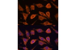 Immunofluorescence analysis of L929 cells using RHBDF1 antibody (ABIN7269977) at dilution of 1:100. (RHBDF1 抗体  (AA 200-400))