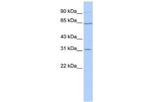 WB Suggested Anti-SLC27A2 Antibody Titration:  1 ug/ml  Positive Control:  Hela cell lysate (SLC27A2 抗体  (N-Term))