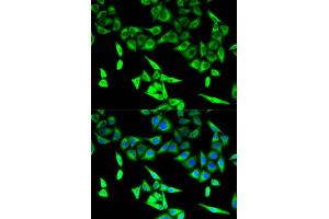Immunofluorescence analysis of U2OS cells using HADHA antibody (ABIN5973083). (HADHA 抗体)