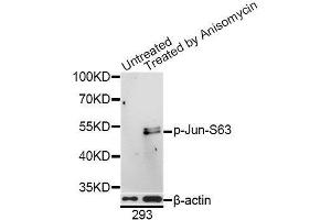 Western blot analysis of extracts of 293 cells, using Phospho-Jun-S63 antibody (ABIN5969905) at 1/1000 dilution. (C-JUN 抗体  (pSer63))