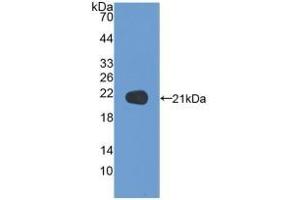 Detection of Recombinant NSF, Human using Polyclonal Antibody to N-Ethylmaleimide Sensitive Factor (NSF) (NSF 抗体  (AA 590-744))