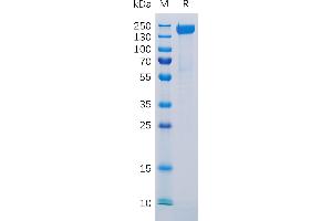 Human CD171 Protein, His Tag on SDS-PAGE under reducing condition.