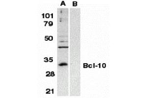 Western Blotting (WB) image for anti-B-Cell CLL/lymphoma 10 (BCL10) (N-Term) antibody (ABIN1031265) (BCL10 抗体  (N-Term))