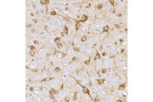 Immunohistochemistry of paraffin-embedded rat brain using USO1 Rabbit mAb (ABIN7271234) at dilution of 1:25 (40x lens). (USO1 抗体)