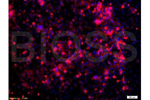 Formalin-fixed and paraffin embedded: human lung epithelial cells labeled with Anti-Glucocorticoid receptor(GR) Polyclonal Antibody, Unconjugated (ABIN726875) at 1:200,, followed by conjugation to the secondary antibody was Goat Anti-Rabbit IgG, PE conjugated at 1:200 for 40 minutes at 37°C (Glucocorticoid Receptor 抗体  (AA 231-320))