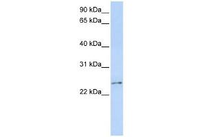 RCAN3 antibody used at 1 ug/ml to detect target protein. (RCAN3 抗体  (Middle Region))