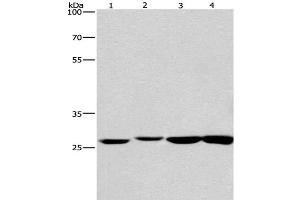 Western Blot analysis of Humna colon cancer and Mouse kidney tissue, Mouse testis and Human fetal brain tissue using KLF7 Polyclonal Antibody at dilution of 1:483. (KLF7 抗体)