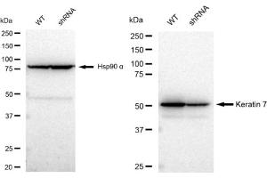 Western blotting analysis using Keratin 7 antibody (ABIN7799186). (Recombinant Cytokeratin 7 抗体)