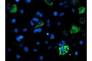 Anti-ACSM5 mouse monoclonal antibody (ABIN2455647) immunofluorescent staining of COS7 cells transiently transfected by pCMV6-ENTRY ACSM5 (RC209798). (ACSM5 抗体)