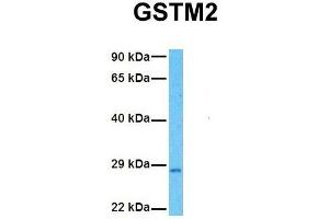 Host:  Rabbit  Target Name:  GSTM2  Sample Tissue:  Human Fetal Liver  Antibody Dilution:  1. (GSTM2 抗体  (N-Term))